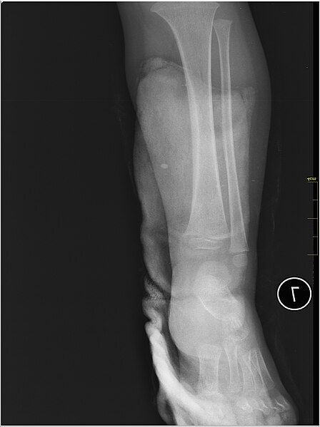 File:Medical X-Ray imaging TNZ07 nevit.jpg