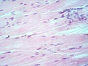 Tisu otot, nukleus sel (biru-ungu), badan sel (merah jambu).