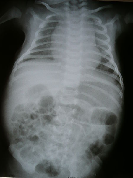 File:Radiology 1300321.JPG