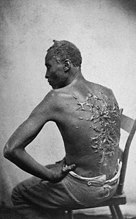 Gordon (slave) American enslaved man