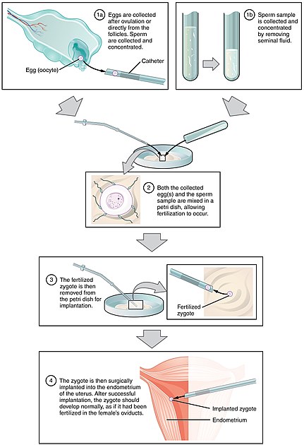 Steps of IVF Treatment