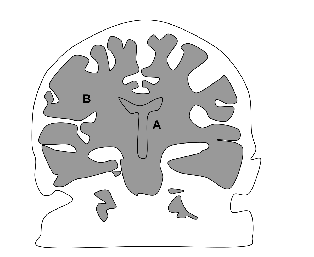 Download File Effects Of The Mediterranean Diet On The Brain Svg Wikimedia Commons Yellowimages Mockups