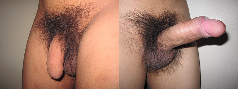 File:Flaccid and erect human penis with pubic hair.jpg