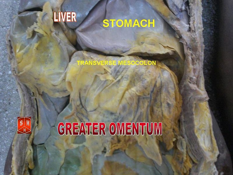 File:Greater omentum 2.jpg