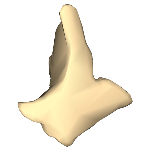 File:Left zygomatic bone close-up lateral.png