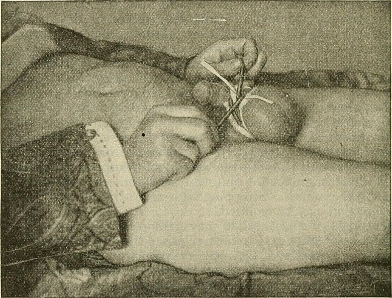 File:Modern surgery, general and operative (1919) (14597609760).jpg