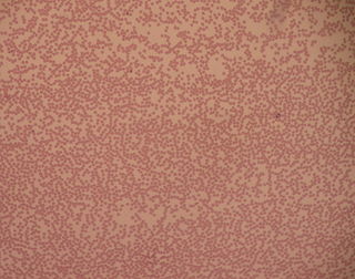 Neutropenia Abnormally low concentration of neutrophils (a type of white blood cell) in the blood