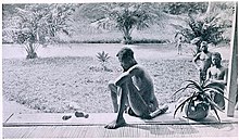 Nsala of Wala in Congo looks at the severed hand and foot of his five-year old daughter, 1904.jpg