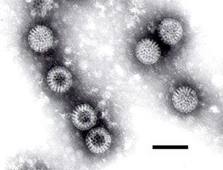 Tập_tin:Rotavirus.jpg