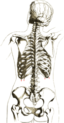 The rib cage, sagittal, and axial subtypes. Rib cage subtype