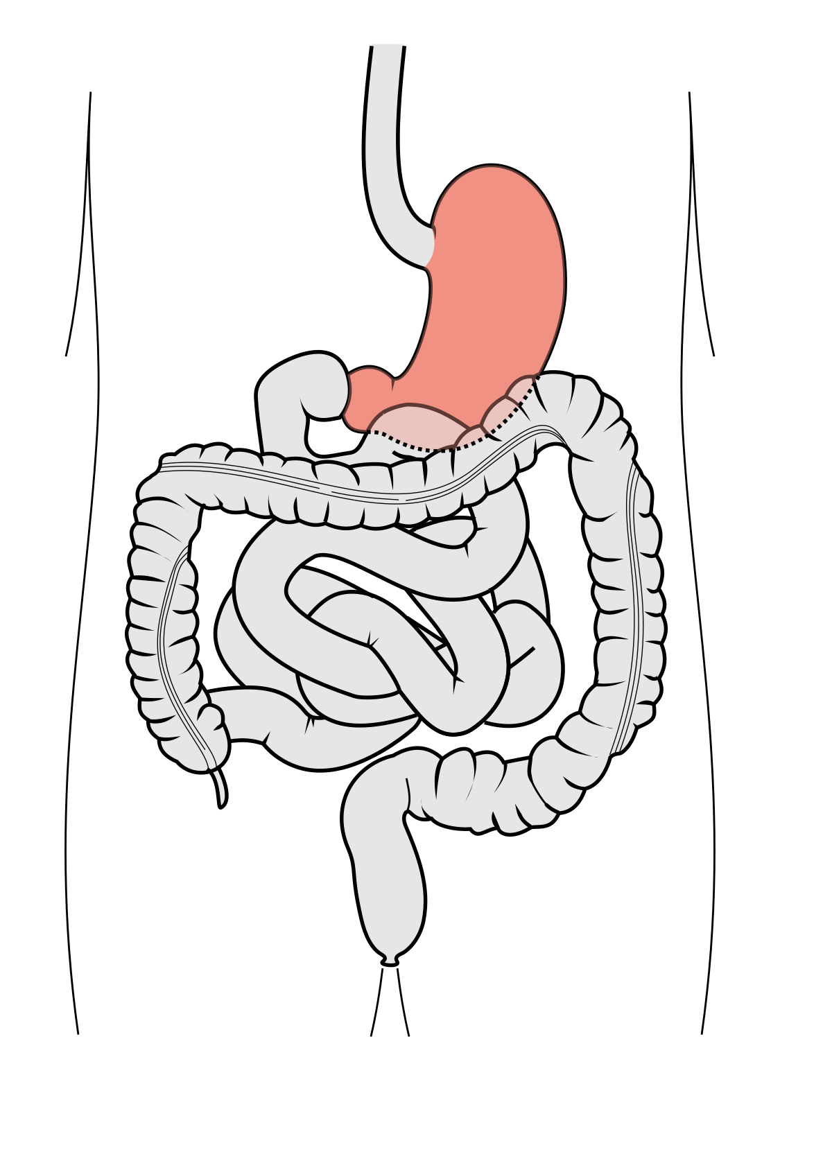 File:Abdominal Quadrant Regions es cleaned.svg - Wikimedia Commons