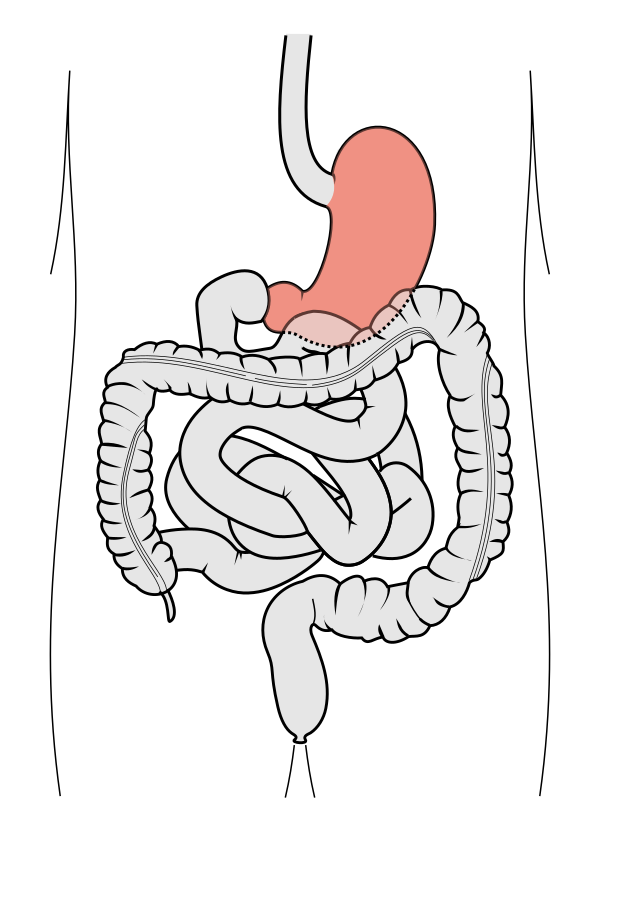 640px Tractus intestinalis ventriculus.svg