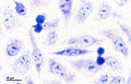 Cell culture (fibroblasts) (261 20) Fibroblasts (metaphase, anaphase).jpg
