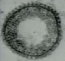 Electron microscope image of a coated vesicle. EM series showing the budding of these kind of vesicles can be seen and CoatedVesiclec.jpg