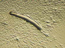 Pseudoplasmodium or "slug" of a Dictyostelium Dictyostelium Pseudoplasmodium.JPG