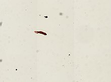 Gyrodactylus elegans (YPM IZ 094251) .jpeg