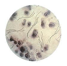 H. ducreyi v řetízcích (barveno krystalovou violetí)