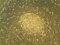 A colony of embryonic stem cells, from the H9 cell line (NIH code: WA09)