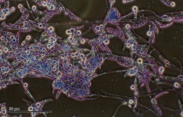 Pythium sp. (Peronosporales), which causes pythiosis in animals, under microscope.