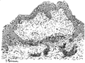 Dermatitis herpetiformis. Cover of vesicle is practically the entire eptthelial layer.In the vesicle are threads of coagulated fibrin and a few leucocytes.The vessels beneath are sheathed with exudation cells.