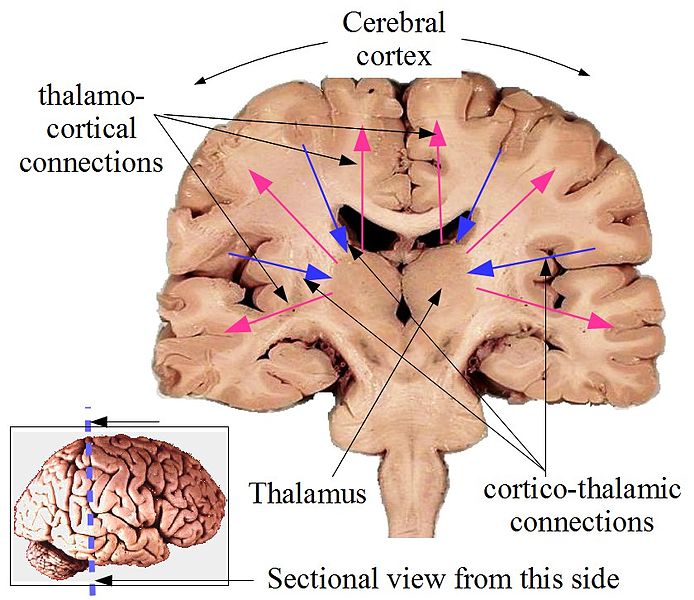 File:Global workspace architeture anatomical.jpg