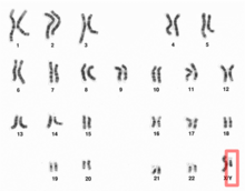 Photographie microscopique des 23 paires de chromosomes humains, parmi lesquelles on distingue la paire des chromosomes sexuels où l'on range le chromosome Y.