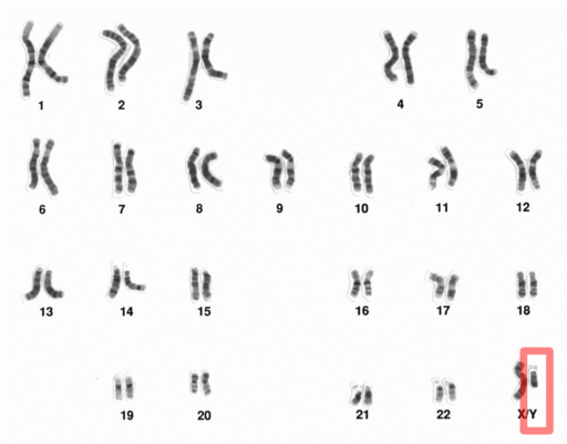 Human male karyotpe high resolution - Chromosome Y