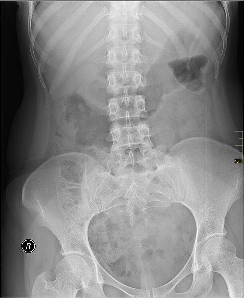 File:Medical X-Ray imaging PPM06 nevit.jpg