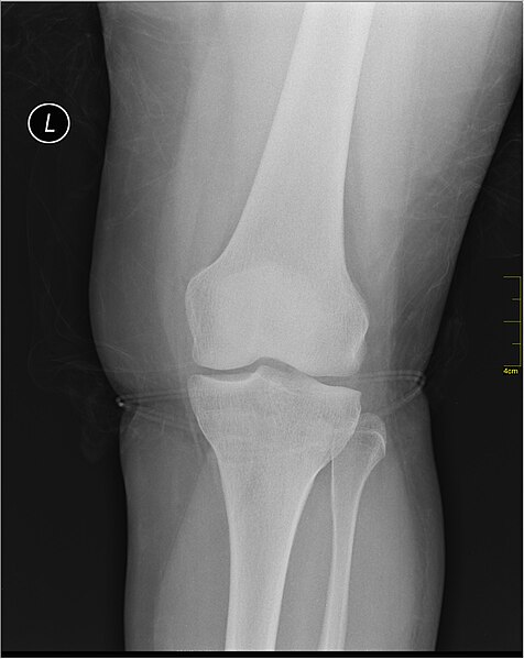 File:Medical X-Ray imaging QYC06 nevit.jpg