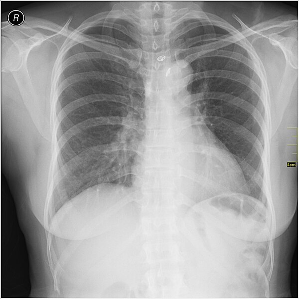 File:Medical X-Ray imaging TMV07 nevit.jpg