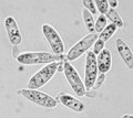Miniatura para Microbotryomycetes