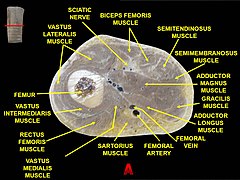 Muscles of thigh. Cross section.