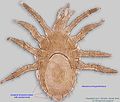 1cecece-Hypoaspis spn ex Tetragonula-pagdeni Malaysia14 dors40x.jpg