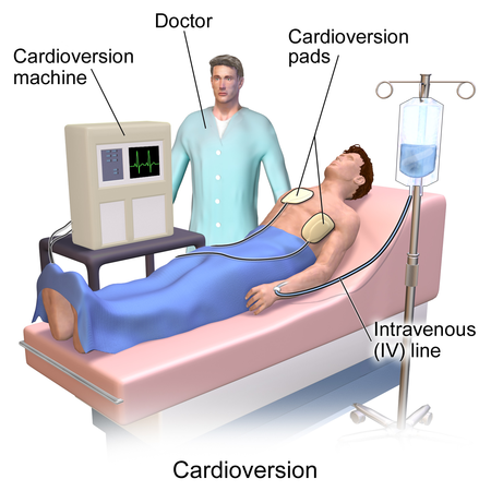 Blausen 0169 Cardioversion.png