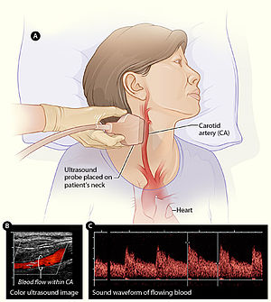 Medical Ultrasound