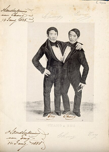 431px-Chang_and_Eng_the_Siamese_twins,_one_holding_a_book._Lithograph_Wellcome_V0007364.jpg (431×600)