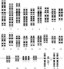 Down syndrome karyotype Down Syndrome karyotype.png