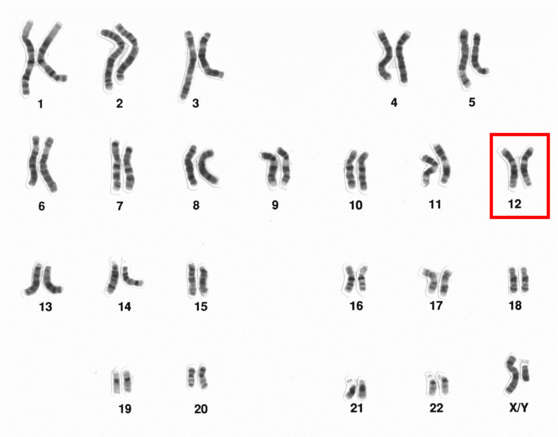 File:Human male karyotpe high resolution - Chromosome 12.png