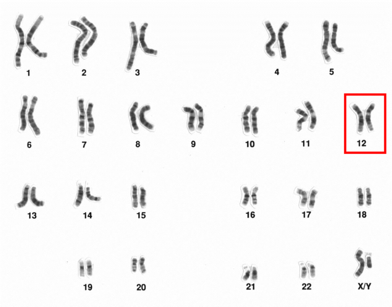 File:Human male karyotpe high resolution - Chromosome 12.png