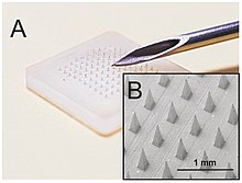 Side comparison of microneedle (350mm in depth) to standard hollow-bore needle Microneedle array comparison with Hypodermic needle.jpg