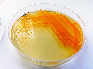 <span class="mw-page-title-main">Chryseobacterium</span> Genus of bacteria