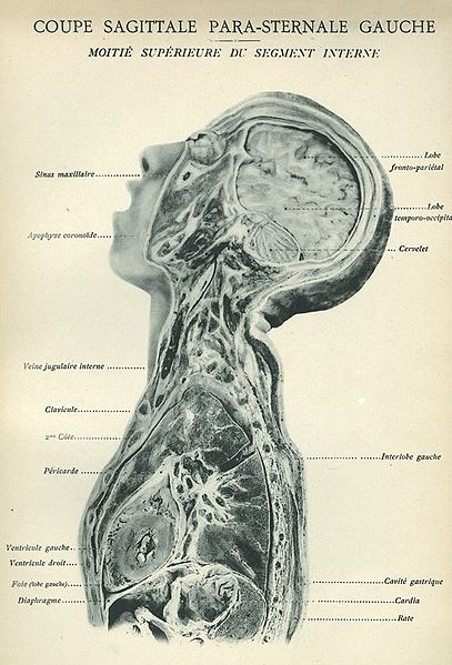 File:Coupe sagittale para-sternale gauche, moitié supérieure du segment interne..JPG