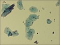 Thumbnail for Gardnerella vaginalis