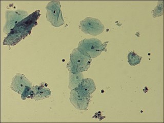 <i>Gardnerella vaginalis</i> Species of bacterium