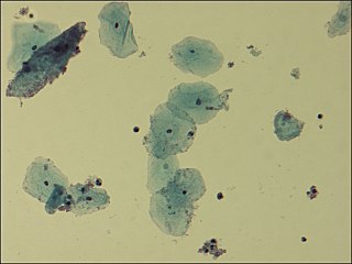 <i>Gardnerella vaginalis</i>