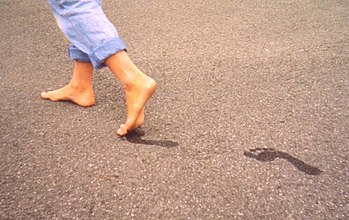 Healthy feet of an 11-year-old girl who regula...