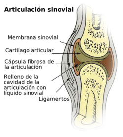 artritis bacteriana sintomas