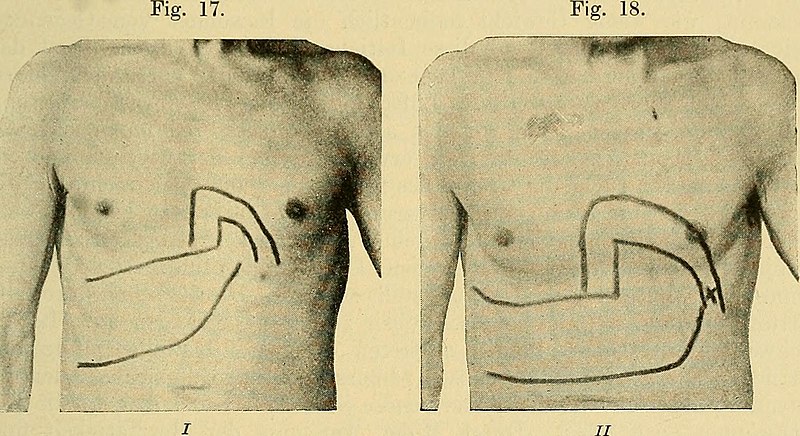 File:Lehrbuch der Krankheiten des Herzens und der Blutgefässe (1906) (14783676045).jpg