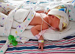 Premature infant in the NICU at McMaster Children's Hospital Mcmaster NICU infant 6978.jpg