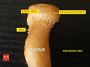 Radius, radial head - posterior view